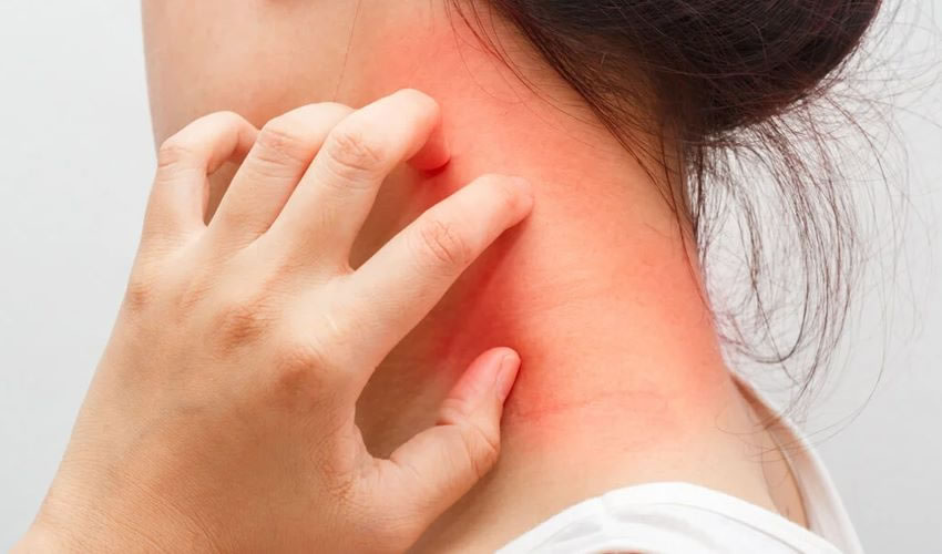 CAMPAÑA DE DETECCIÓN GRATUITA DE DERMATITIS ATÓPICA Portal de