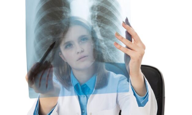 CANCER DE PULMON  “CONTEN LAB AR 2750 11/2020”