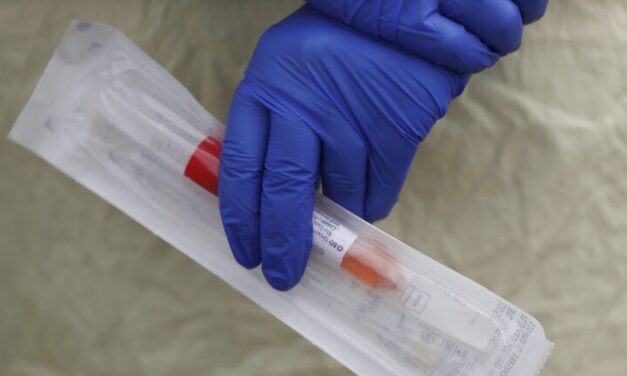 CÓMO ES LA PRUEBA QUE DETECTA EL CORONAVIRUS A TRAVÉS DE LA PIEL