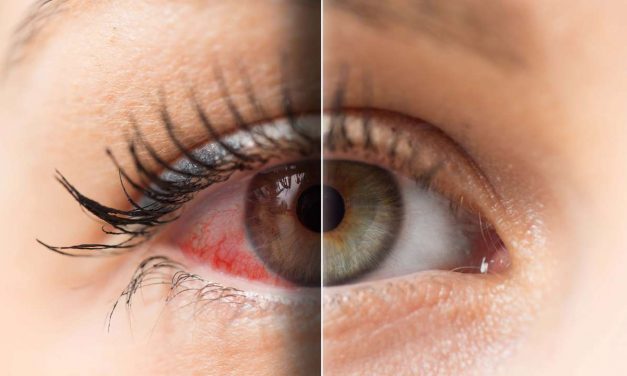 TIPS PARA LA PREVENCIÓN Y EL CUIDADO DE LA SALUD VISUAL