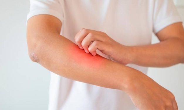 CAMPAÑA DE DETECCIÓN GRATUITA DE ENFERMEDAD PSORIÁSICA