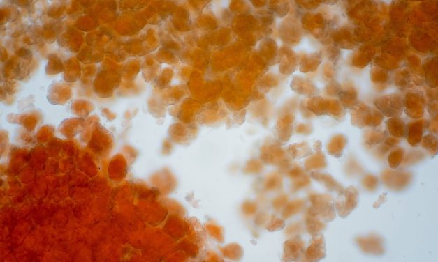 Descubren neuronas que conectan la grasa corporal con el cerebro