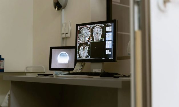 Espasticidad: una secuela del ACV que puede aparecer en el 20-30 por ciento de los pacientes