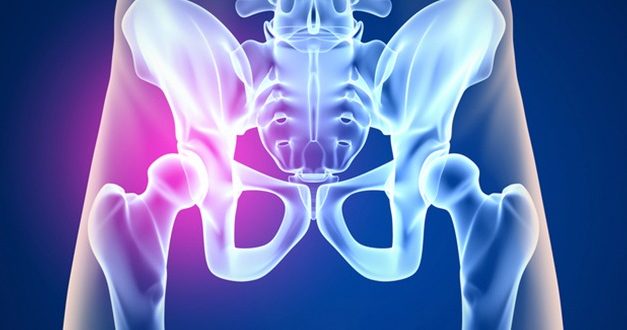 Osteoporosis: una enfermedad que en Argentina causa unas 34 mil fracturas de cadera por año