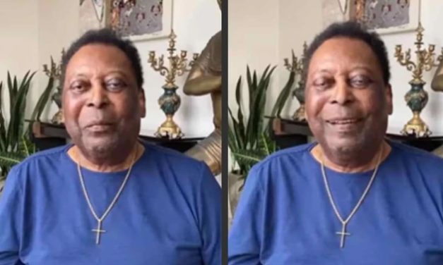 Anasarca, el cuadro de hinchazón generalizada que afecta a Pelé