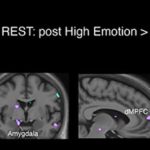 ¿Dominar mejor nuestras emociones puede ayudarnos a prevenir patologías cerebrales?