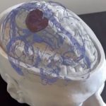 Un nuevo desarrollo argentino revoluciona los quirófanos y promete transformar las cirugías cerebrales