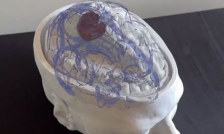 Un nuevo desarrollo argentino revoluciona los quirófanos y promete transformar las cirugías cerebrales