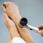 Alertan por la alta incidencia de casos de cáncer de piel en la Argentina: los expertos recomiendan controles