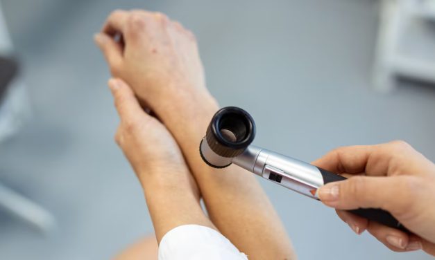 Alertan por la alta incidencia de casos de cáncer de piel en la Argentina: los expertos recomiendan controles
