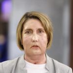 Un nuevo rostro y una segunda oportunidad: el trasplante facial que marca un hito médico mundial