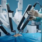 Los cinco beneficios de la cirugía robótica para los pacientes