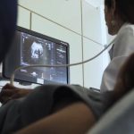 La condición genética poco frecuente que puede afectar múltiples órganos y retrasar el diagnóstico