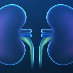 Cáncer de riñón: la enfermedad que se desarrolla en silencio