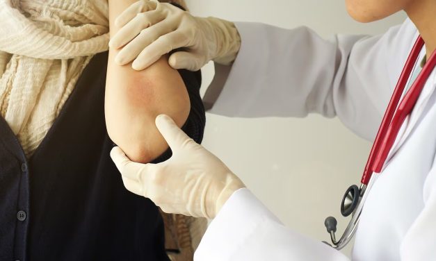 CAMPAÑA DE DETECCIÓN GRATUITA DE ENFERMEDAD PSORIÁSICA