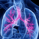 8 de septiembre, Día Mundial de la Fibrosis Quística: por qué el diagnóstico temprano puede cambiar la calidad de vida